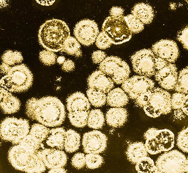 Sour Microbes Yeast And Bacteria Explained American Homebrewers Association